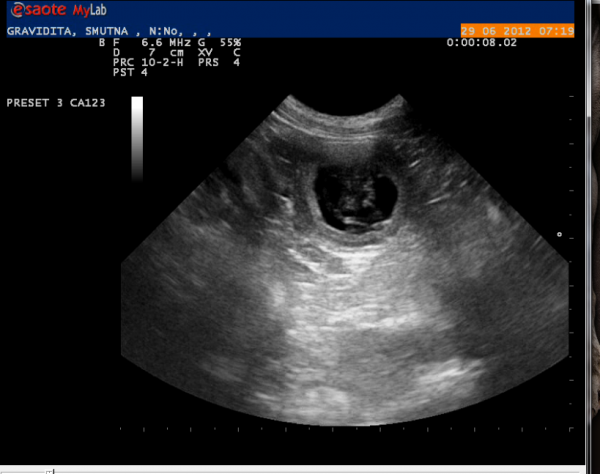 sonograph.png
